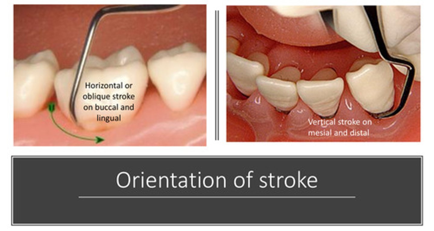 <p>vertical stroke</p>