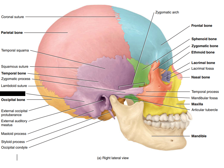 <p>State and identify what part of the cranial bone is being pointed out and censored. </p>