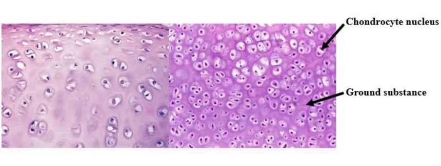 <p>Chondrocytes</p>
