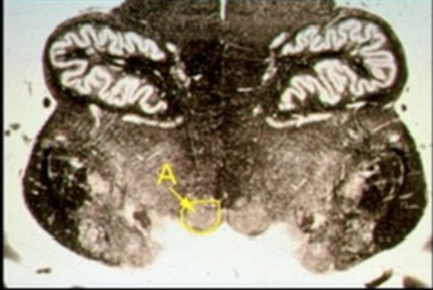 <p>Identify the structure indicated by the outline and letter "A."</p>