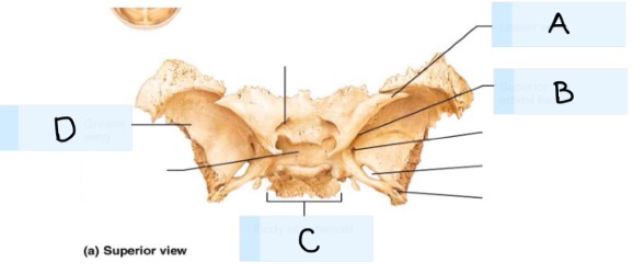 <p>what bone is this?</p>