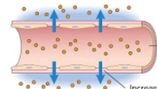 <ul><li><p>high protein content and white and red blood cells</p></li><li><p>fluid and protein leakage </p></li><li><p>vasodilation and stasis </p></li><li><p>increased interendothelial spaces </p></li></ul><p></p>