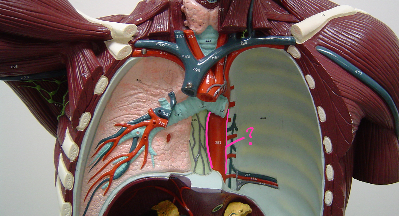 <p>what blood vessel is this? (in pink)</p>