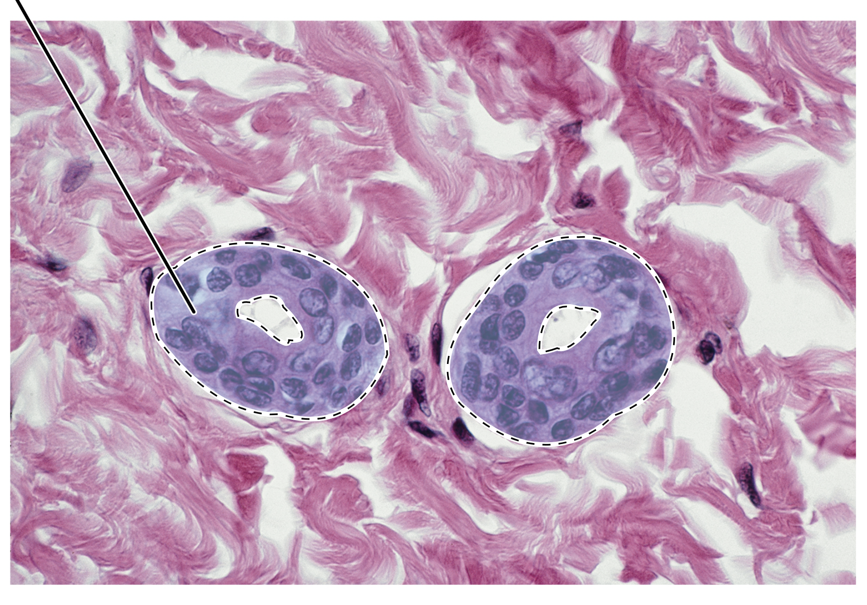 <p>Name the highlighted tissue.</p>