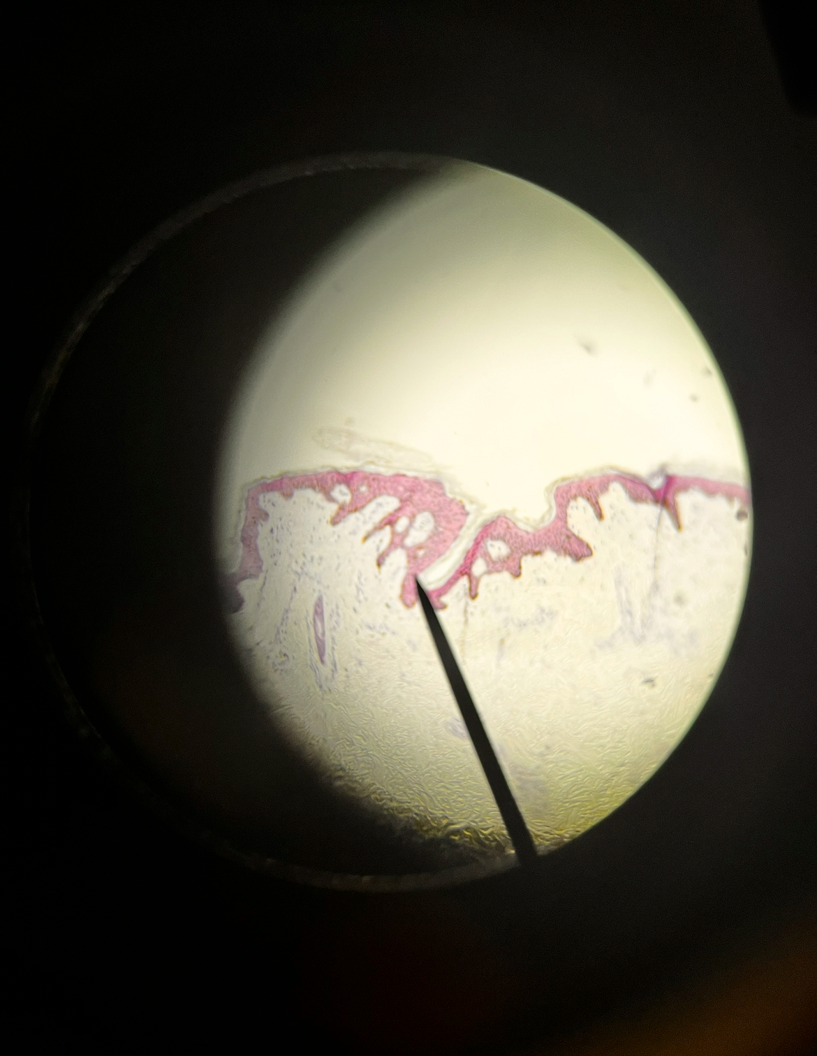 <p><span>Name the region that the pointer is on.</span></p><p><span>Name the tissue the pointer is on.</span></p><p><span> Pigmented or non-Pigmented</span></p>