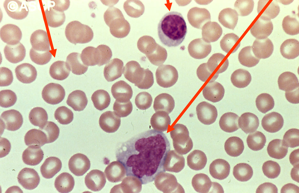 <p>What normoblastic maturation stage is in the image? (Shortest arrow)</p>