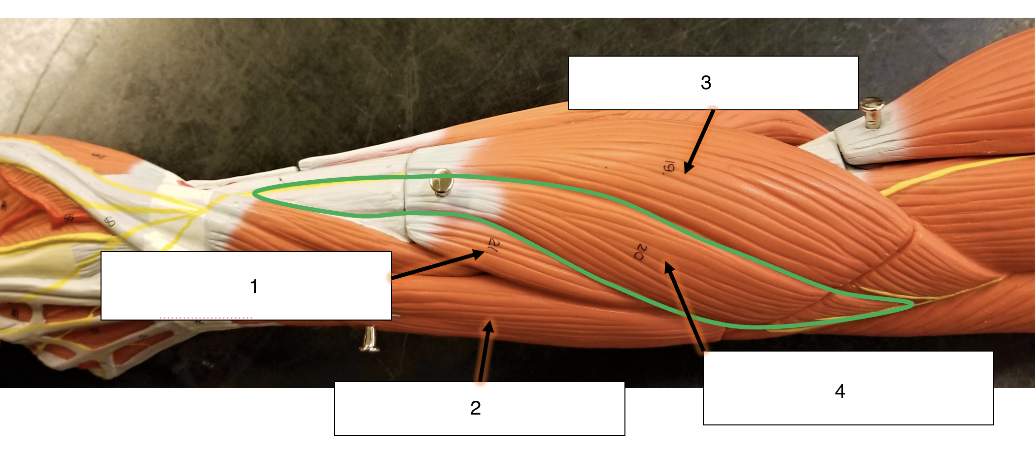 <p>name the muscle (4)</p>