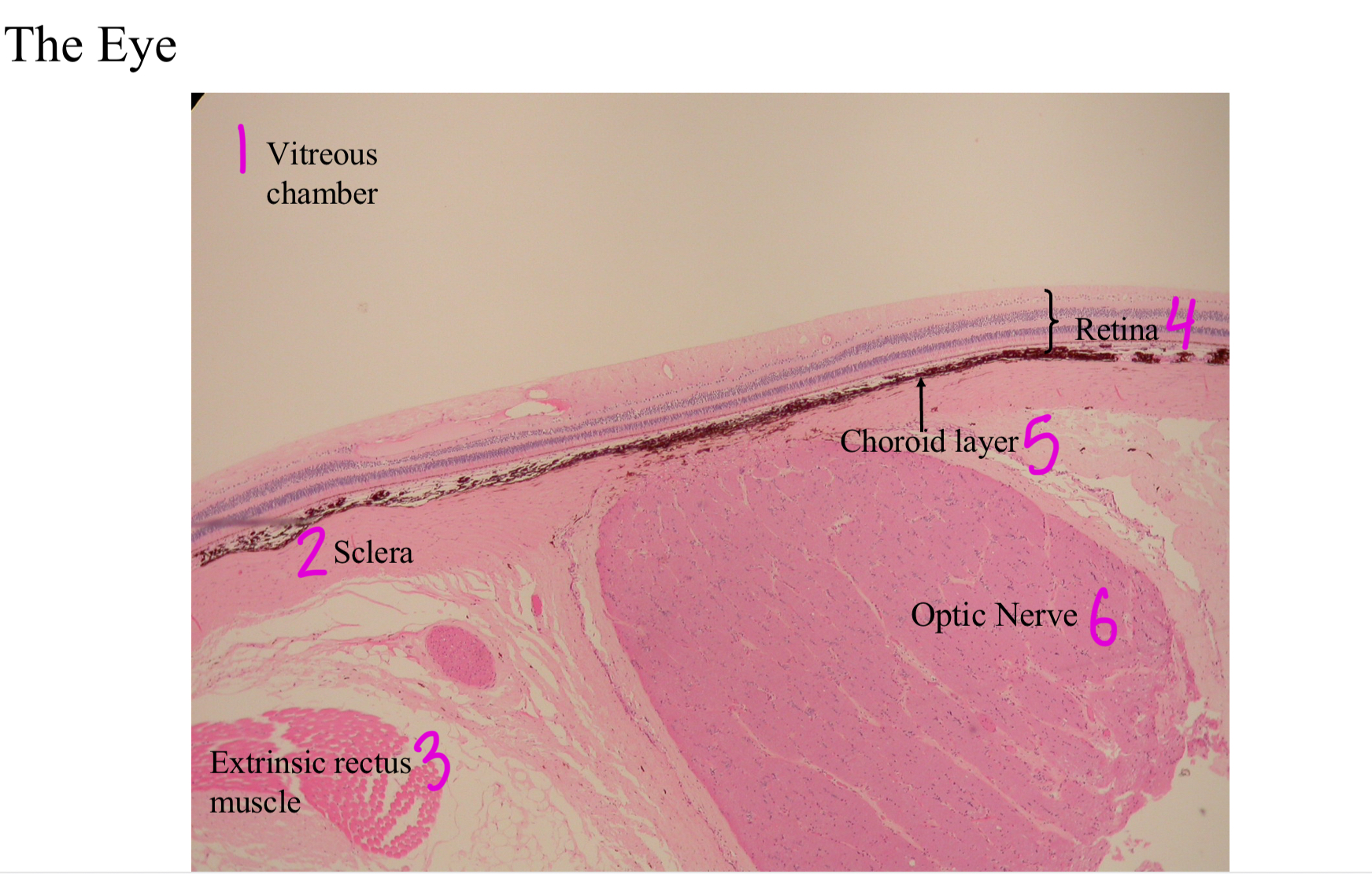 <ol><li><p>Vitreous chamber</p></li><li><p>Sclera</p></li><li><p>Extrinsic rectus muscle</p></li><li><p>Retina</p></li><li><p>Choroid layer</p></li><li><p>Optic nerve</p></li></ol>