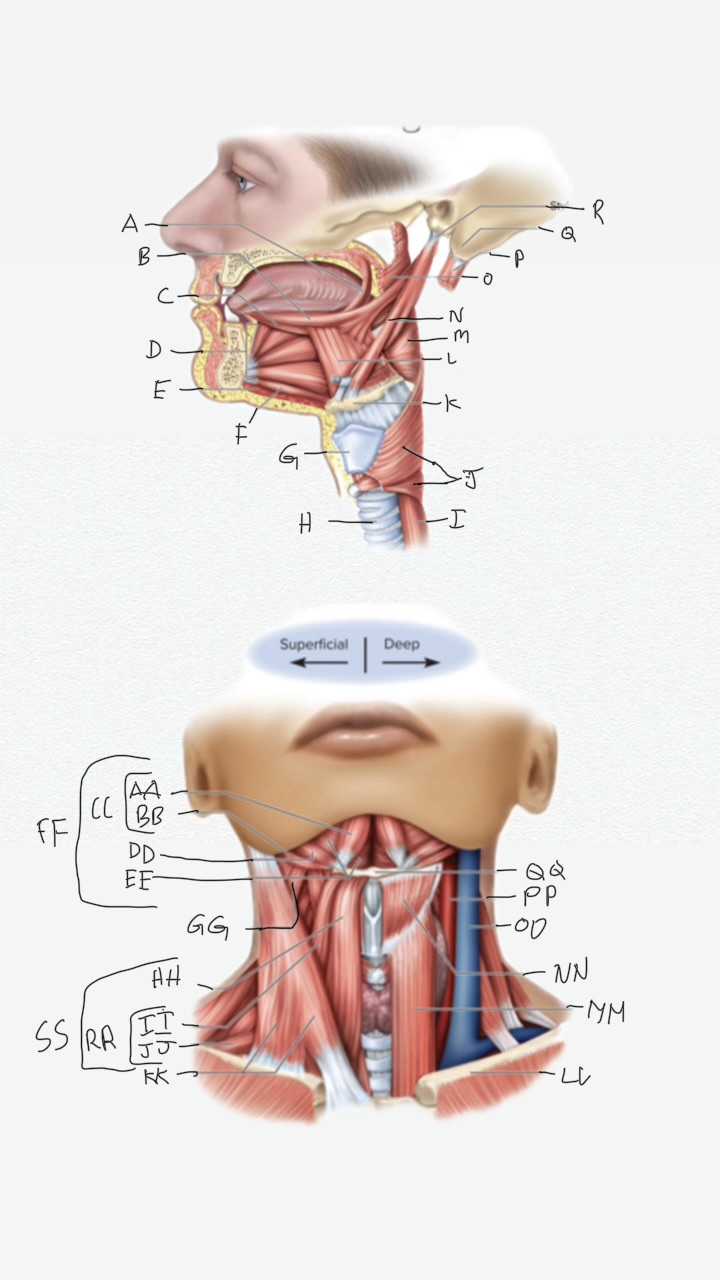 <p>II</p>