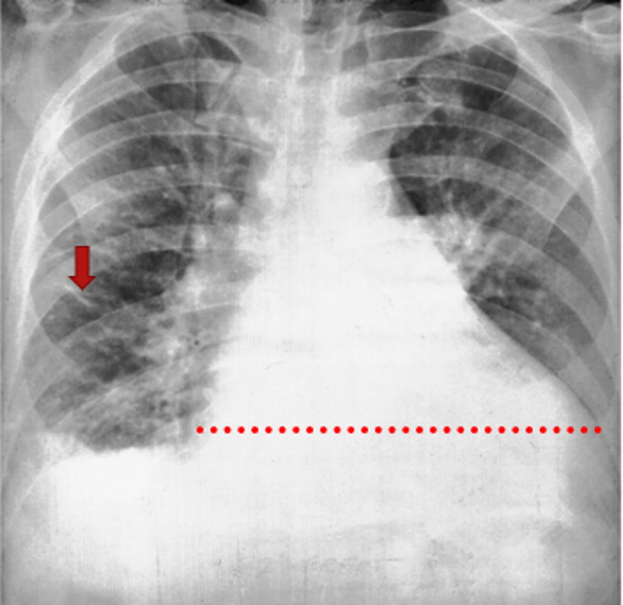 <p>Interpretation?</p>