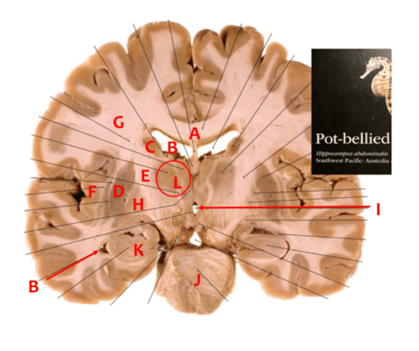 <p>Label the following letters with their respective structures : A,B,C,D,E,F,G,H,I,J, K,L</p>