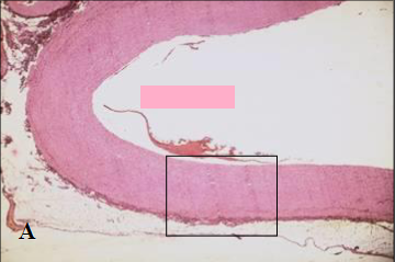Magnification 