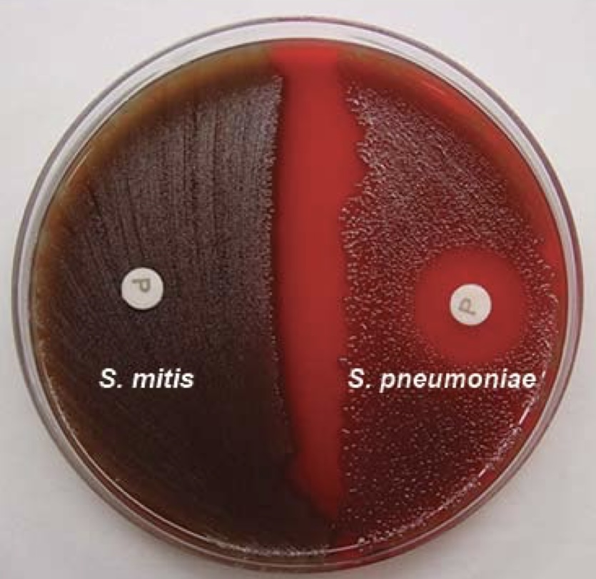 <p>Identification for <em>S. pneumoniae</em></p><ul><li><p>was not performed in lab</p></li><li><p>a zone of inhibition indicates a positive result for <em>S. pneumoniae</em></p></li></ul>