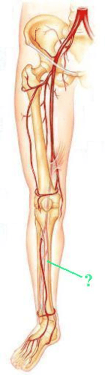 <p>Identify the indicated blood vessel.</p>