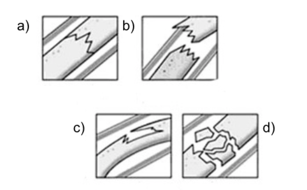 <p><span>Label each image in order with its associated fracture type</span></p>