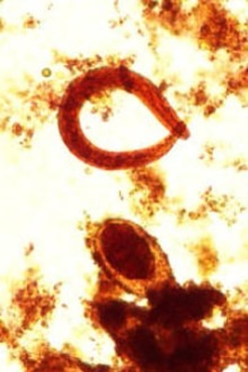 <p>Identify the parasite</p>