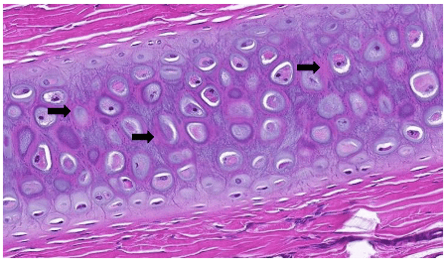 <p>What is the staining characteristic of Type II collagen fibers?</p>