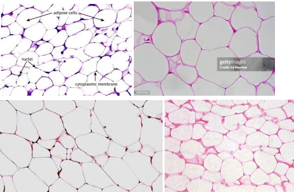 <p>These <strong>APPEAR LIKE EMPTY SACS</strong>, but it’s ACTUALLY COLORLESS LIPIDS with things that are stored inside</p>
