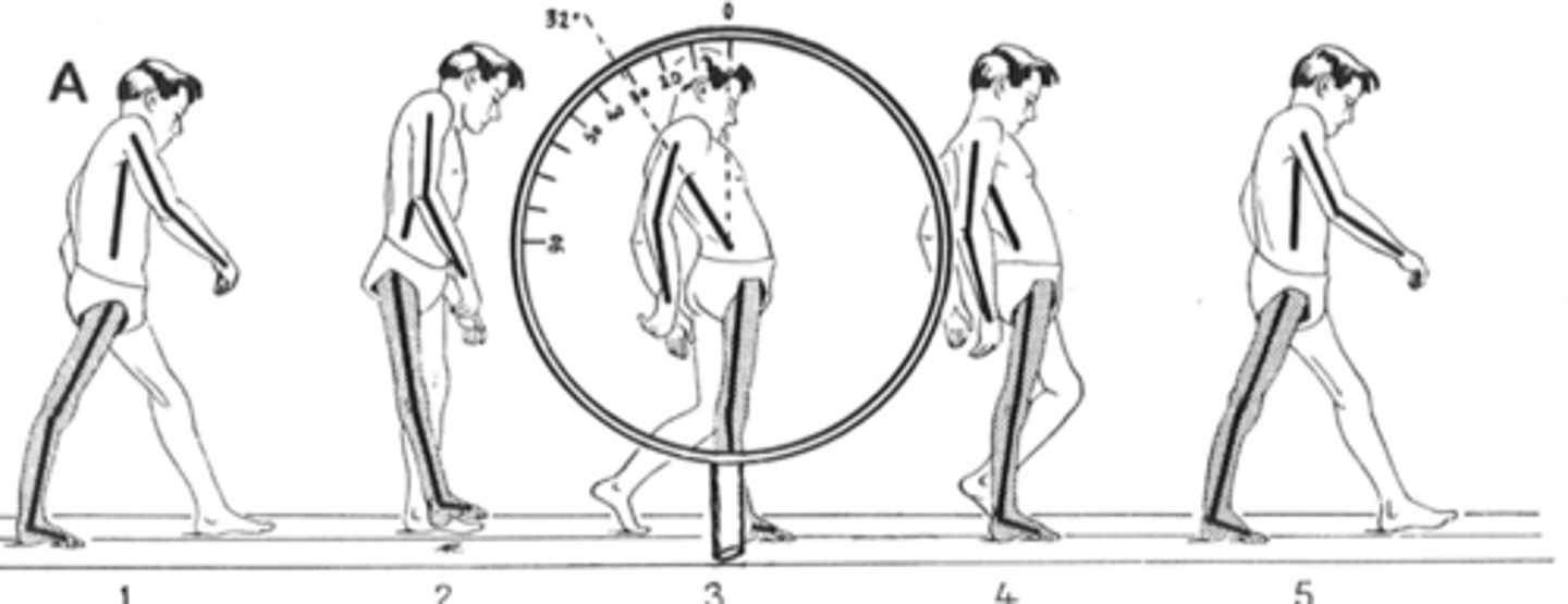 <p>Stance Phase:</p><p>-Weak hip extensors</p><p>-Hip flexion rigid contracture</p><p>Swing:</p><p>-hip flexor weakness (lean back to fling leg forward and get further)</p>