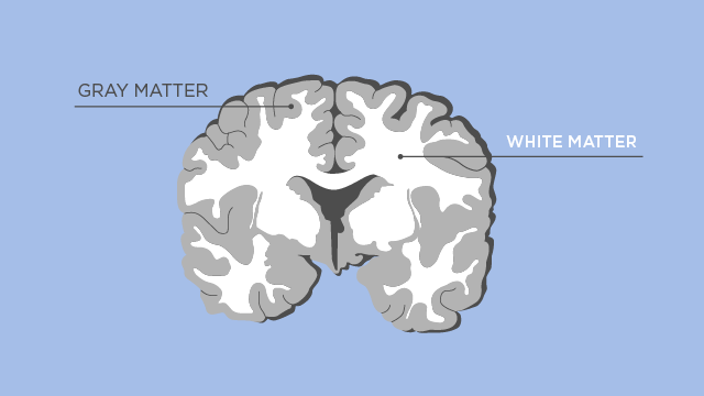 <p>Outost layer of cerebral cortex (visible)</p><ul><li><p>Comprised of neuron cell bodies (somata) and unmyelinated axons</p></li></ul>