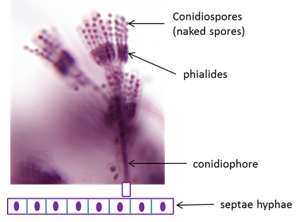 <ul><li><p>medically important mold</p></li><li><p>spores are green and hyphae are white</p></li><li><p>can cause a lung infection in immunocompromised patients</p></li><li><p>some strains are used to make blue cheese and brie cheese</p></li></ul><p></p>