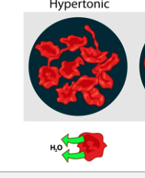 <p>Solution with higher concentration of Solute</p>