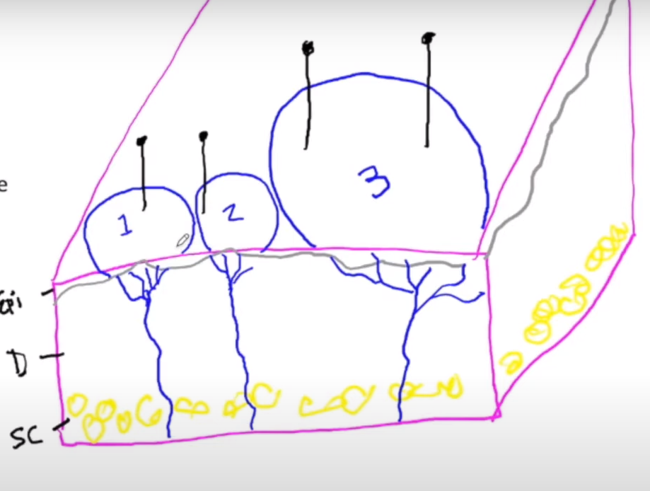 <p>-acuity = ability to sense/differentiate a signal</p><p>-more small dense RFs = higher acuity, lower discriminatory distance</p><p>-aka dense can detect more</p><p>(in the image, 1&amp;2 detect 2 diff stim, but 3 is so big that 2 diff stim get detected as being in the same area)</p>