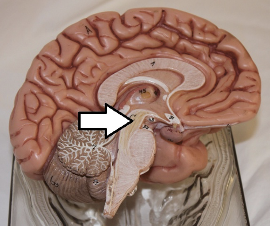 <p>identify this part of the brain</p>