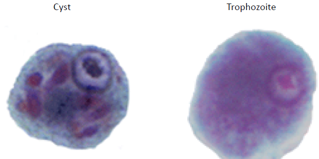 <p>Cyst</p><ul><li><p>many small chromatid bodies with angular/pointed ends</p></li></ul><p>Trophozoite</p><p></p>