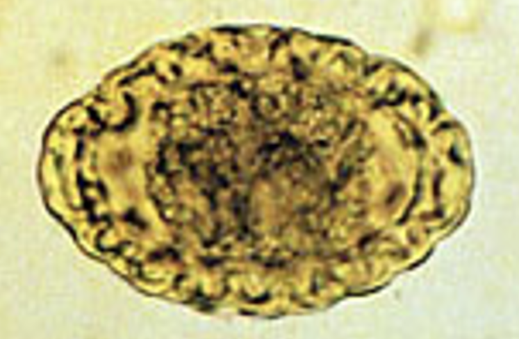 <p>Give the genius, species and common name for this <strong>canine </strong>parasitic egg</p>