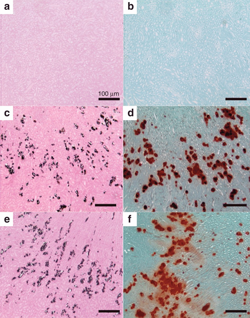 <p>Alizarin Red or Von Kossa.  </p>