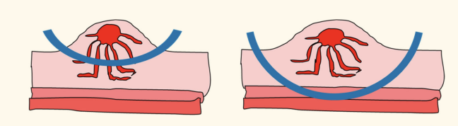 <p>FISS: sx</p><ul><li><p>concerns</p></li><li><p>to do this properly</p></li></ul><p></p>