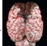 <p>Black brown pigment produced by melanocytes </p><p>ONLY endogenous black brown pigment </p><p>Non pathologic: skin, retina, meninges</p><p>Pathologic: melanocytic neoplasm, hyperpigmentation in skin</p>
