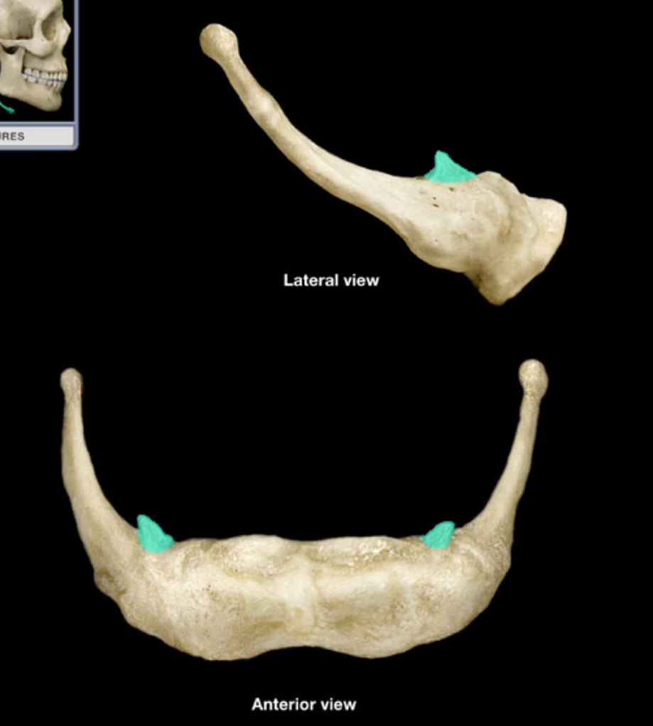 <p>what part of the bone is highlighted </p>