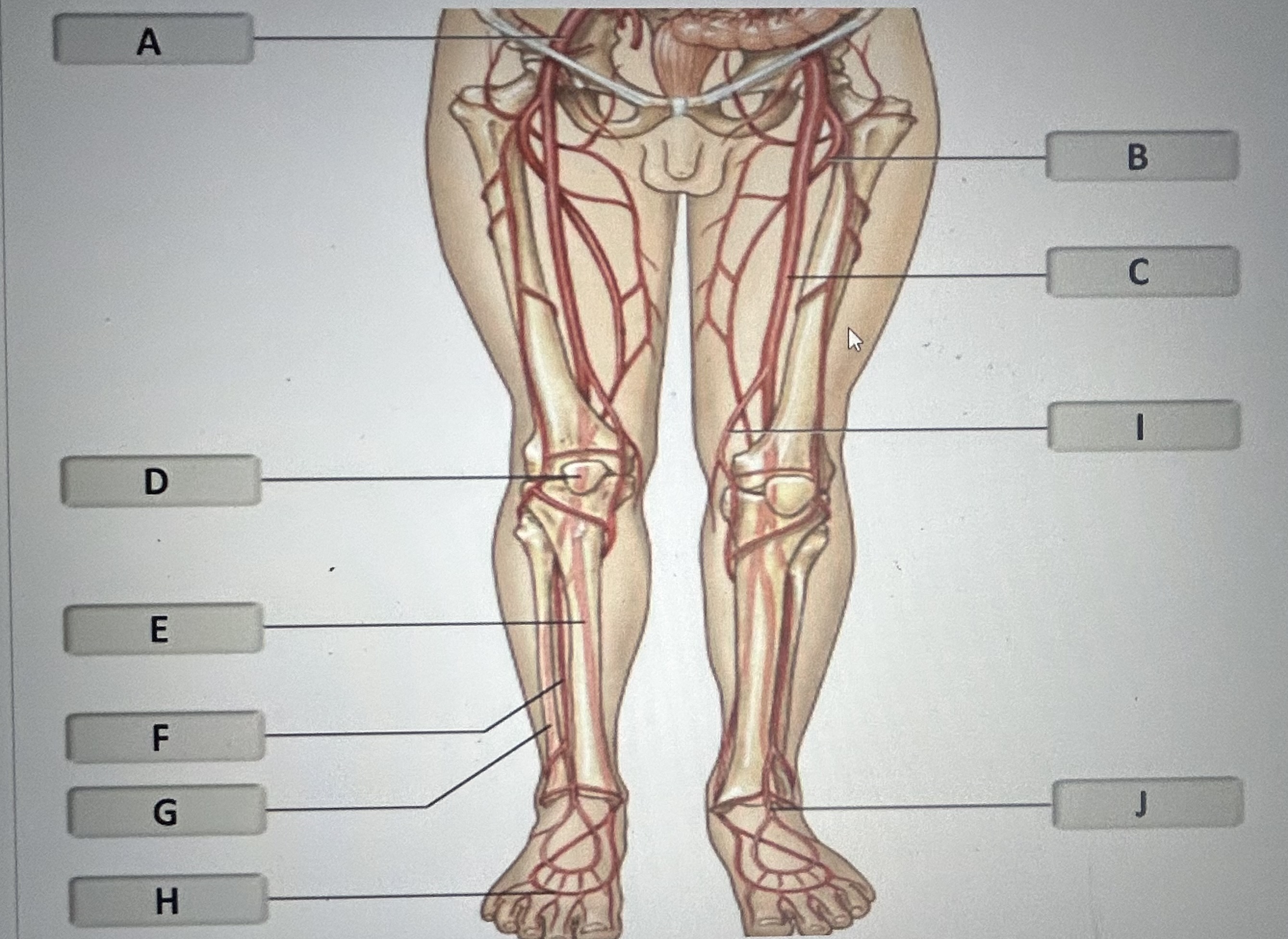 Identify the major artery labeled I