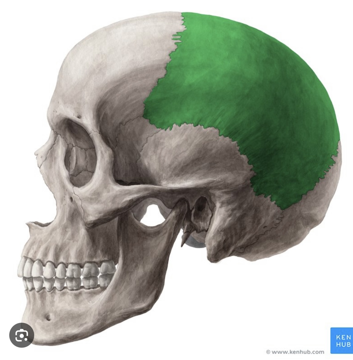 <p>Left parietal bone</p>