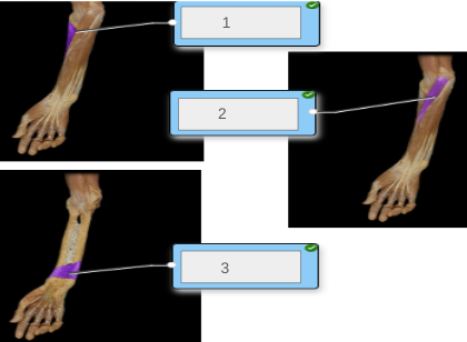<p>muscles 1-3</p>