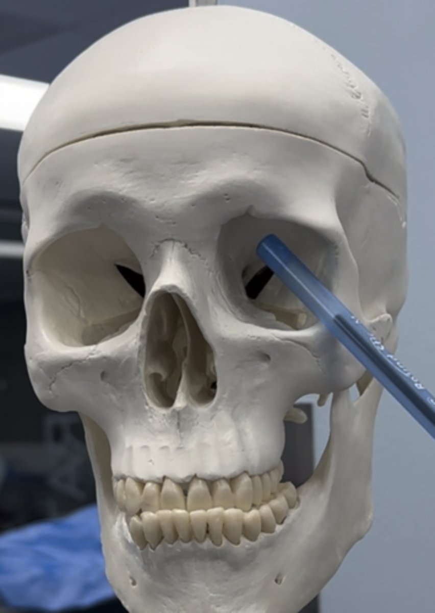 <p>Upper part in the orbit</p>