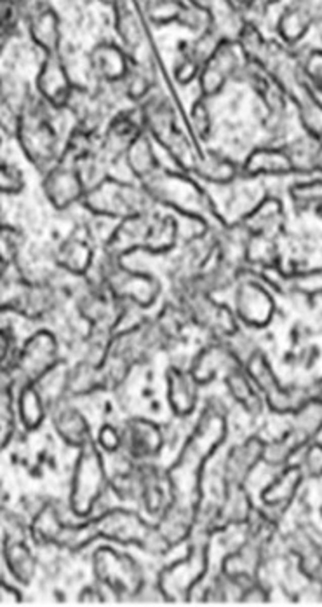 <p>doesn't work with ribosomes, so no granulated appearance</p><p>- Builds lipids</p><p>- Builds new membrane</p><p>- Detoxification of non-polar drugs</p>