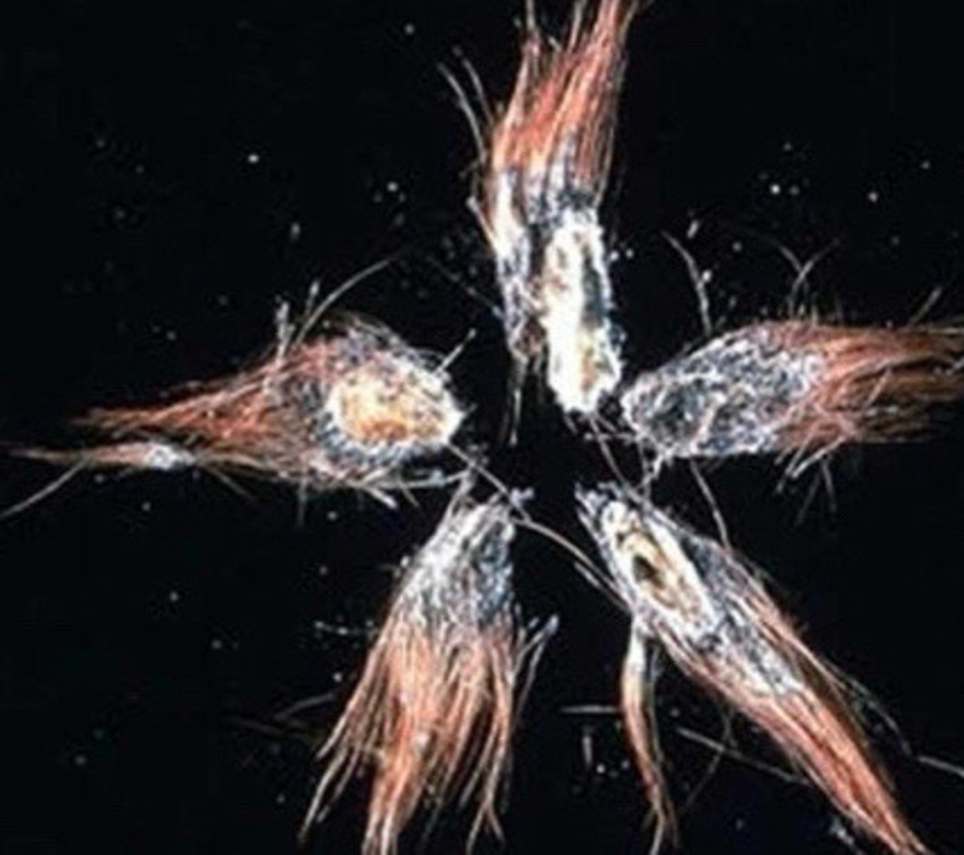 <p>What is this paintbrush lesion?</p>