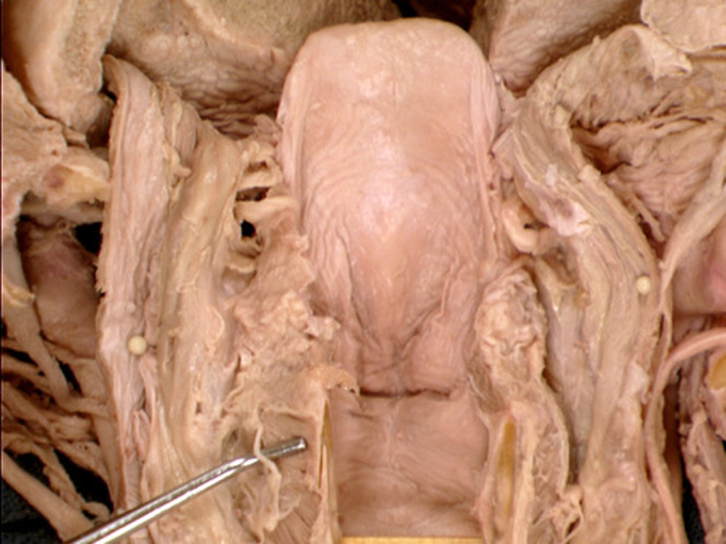 <p>Name the Nerve</p>