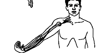 <p>radial N</p><p>C5-T1</p>