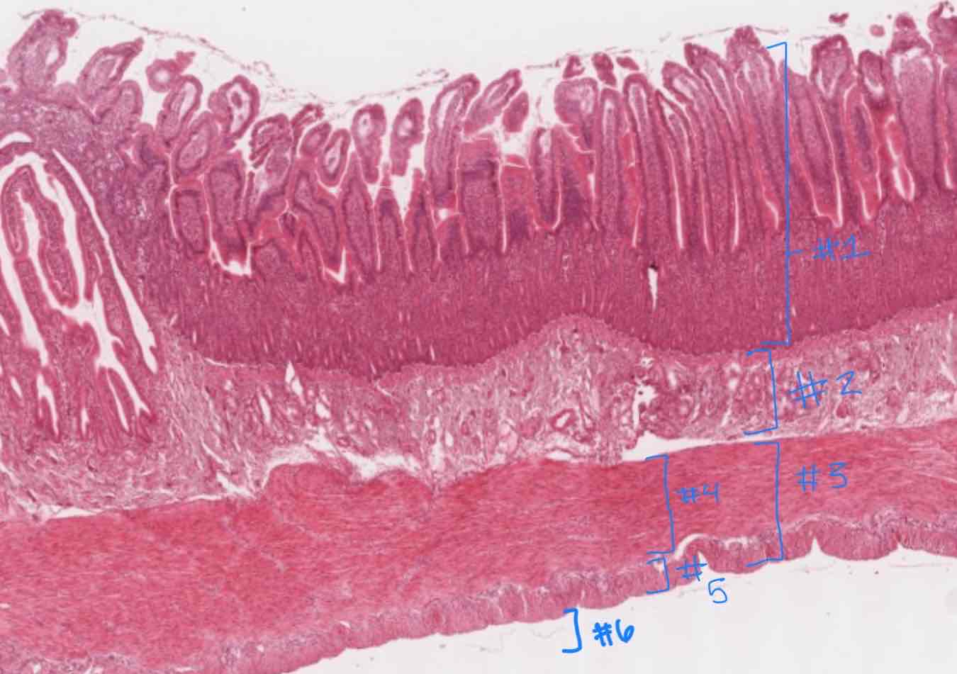 <p>What major layer is indicated by #6?</p>