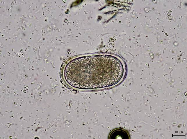 <p>? in poultry</p>