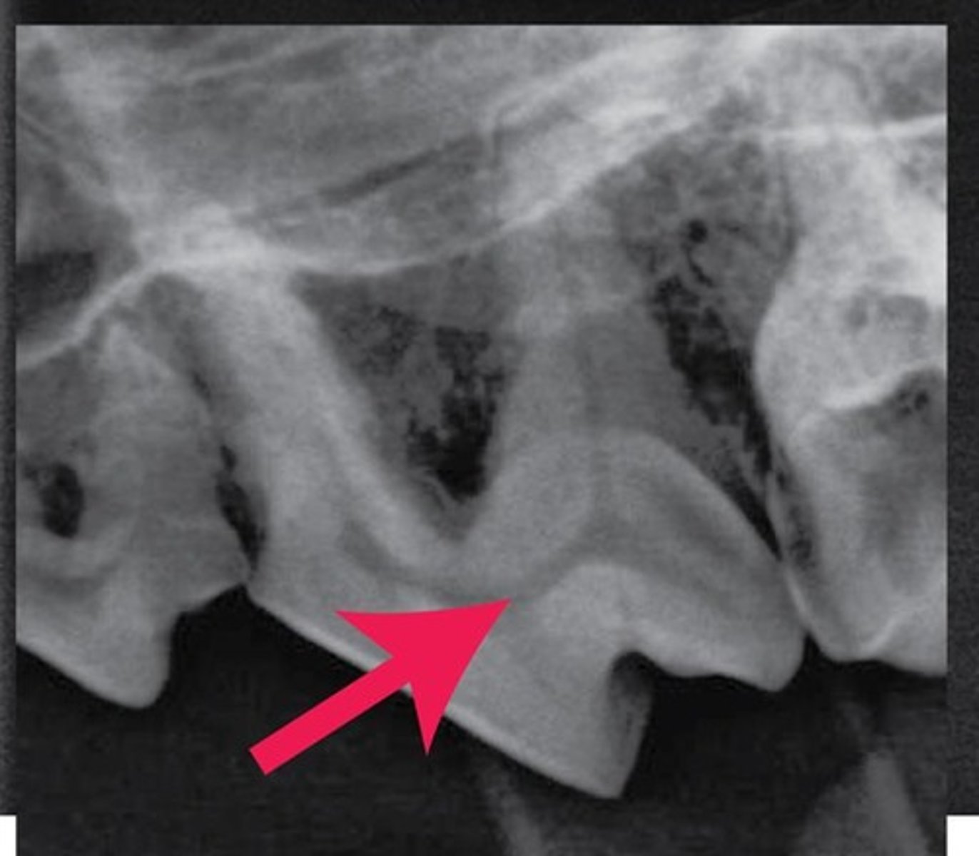 <p>The arrow is pointing to what "space" found within the tooth? Also, what is the term for the "substance" found within this space?</p>