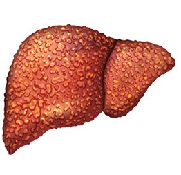 <p>What pathology is shown here?</p>
