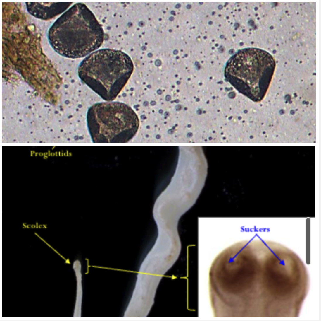 <p>SMALL INTESTINE Your lambs have diarrhoea , anaemia and weight loss after 6-8 weeks of being on a pasture used by adult sheep.</p><ul><li><p>Ingestion of cysticercoid larvae in orbatid mites (IH)</p></li><li><p>2 sets of reproductive organs, 2 genital pores</p></li><li><p>Triangular eggs with pyriform apparatus</p></li></ul>