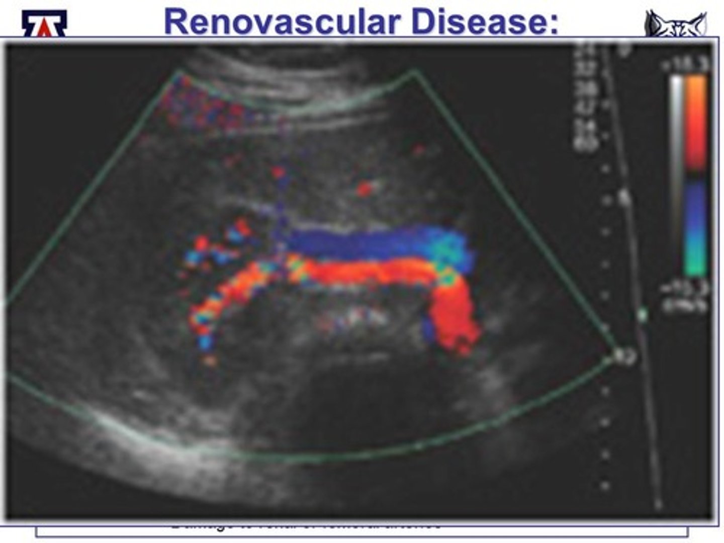 <p>allows for visualization of movement and blood flow in real time without the use of radiation</p>
