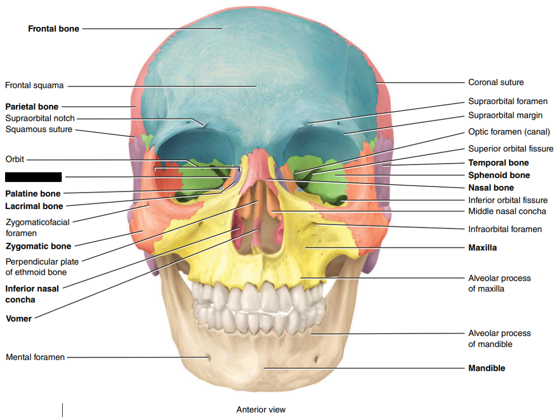 <p>State and identify which part of the cranial bone is being censored.</p>