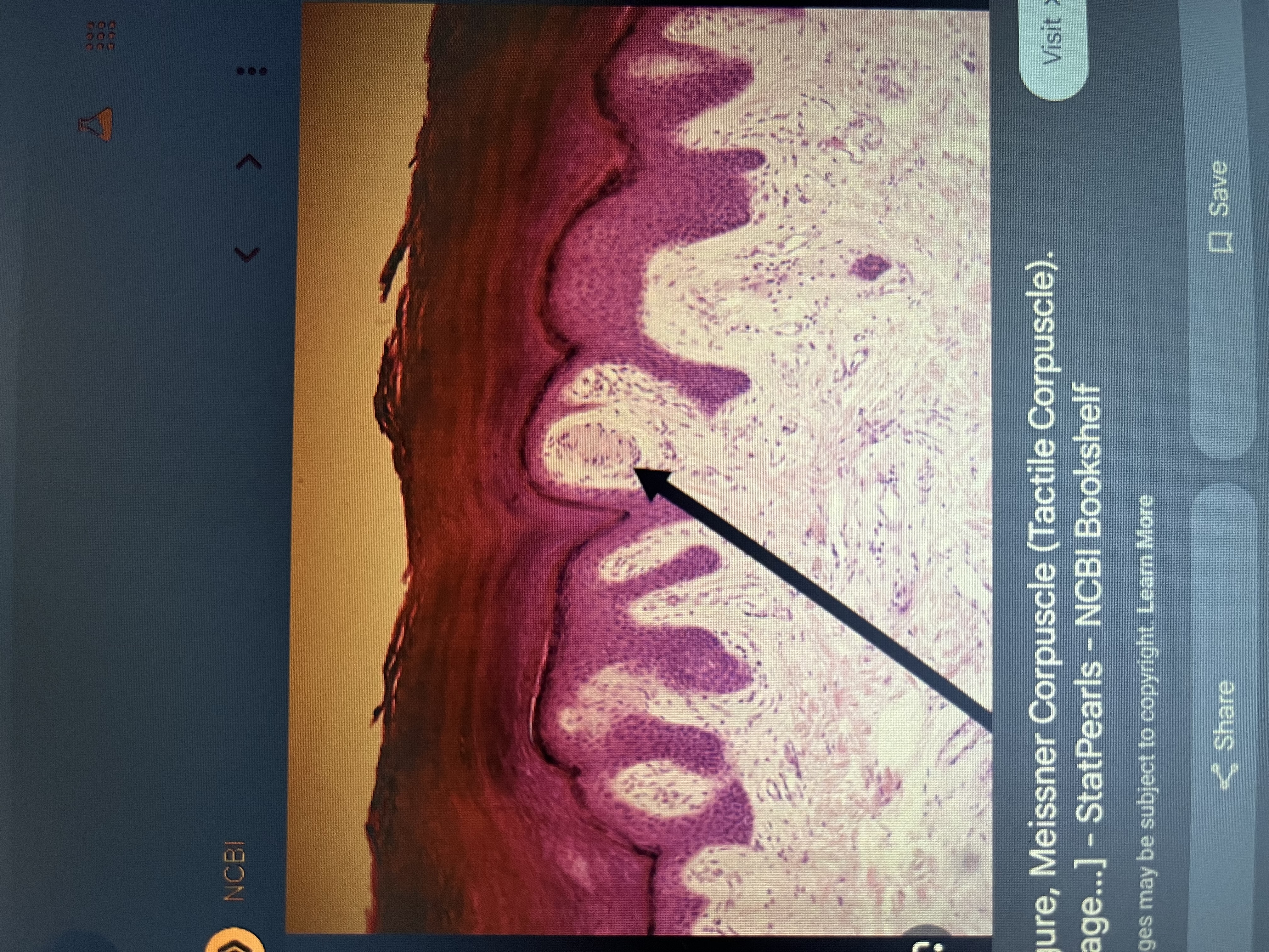 <p>A light touch receptor located in the dermal papillae; detects fine touch.</p>